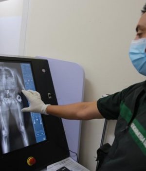 Body Scan Gendarmeria-libero