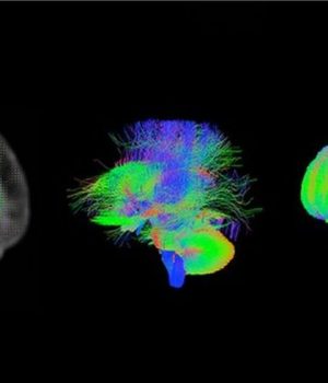 Conexiones neuronales-bbc